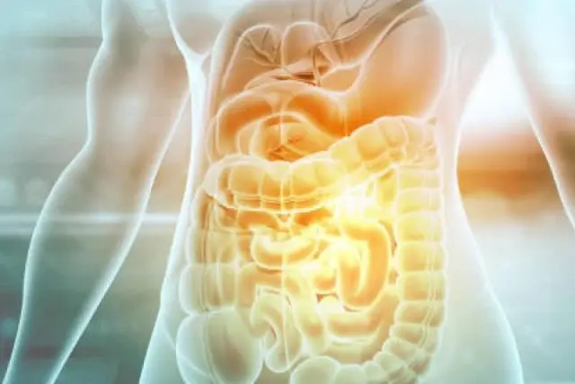 Restaurar butirato mejora barrera intestinal y aumenta supervivencia en modelos experimentales .. iStock