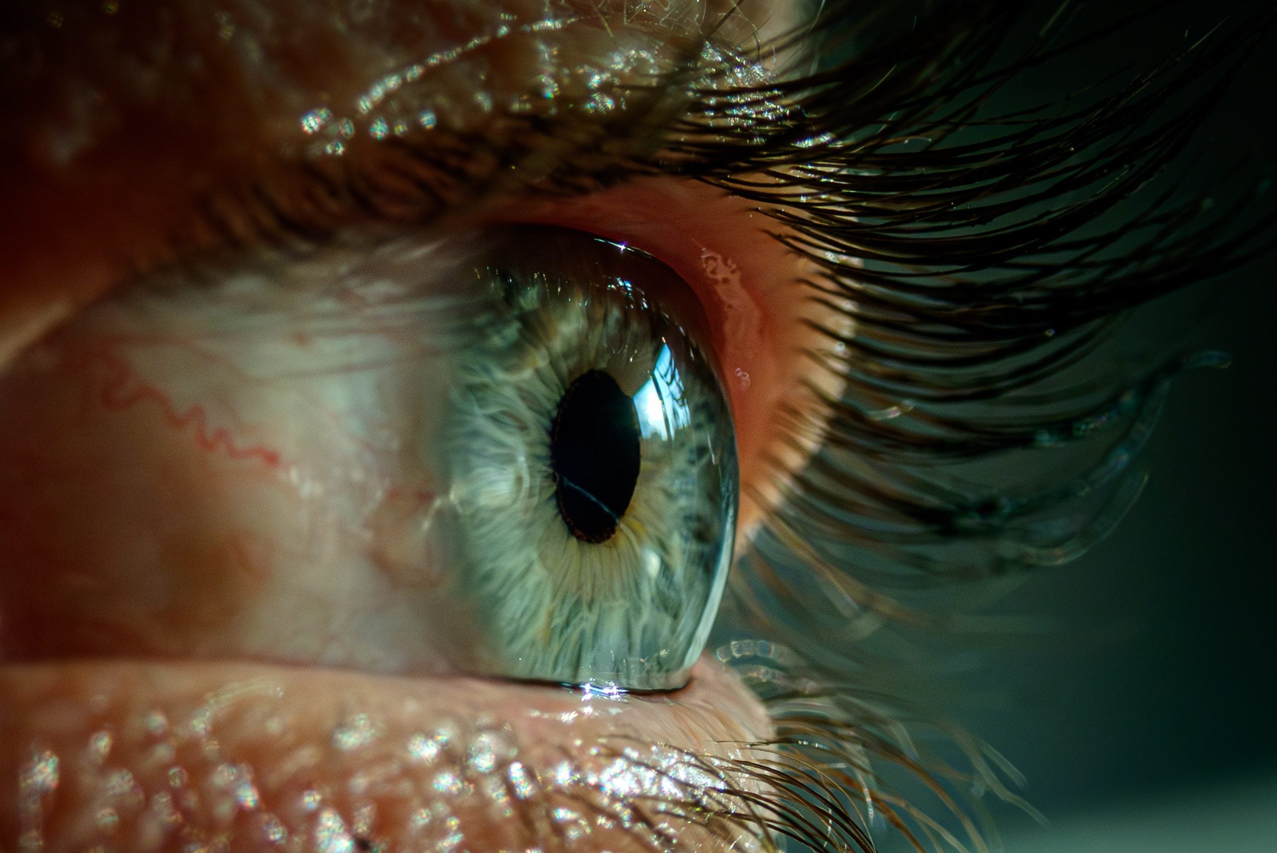 FDA approves Glaukos’ Epioxa as incision-free corneal disease treatment