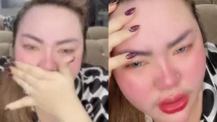 Lisa Mariana Akui Sakit, Tapi Tak Hadiri Pemeriksaan Bareskrim, Terbongkar di Siaran Langsung