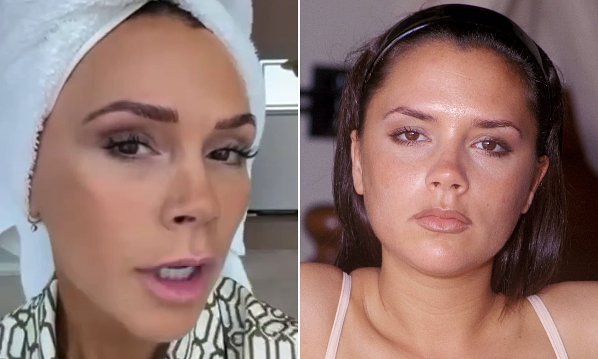 Victoria Beckham recalls her battle with problematic skin during her ...