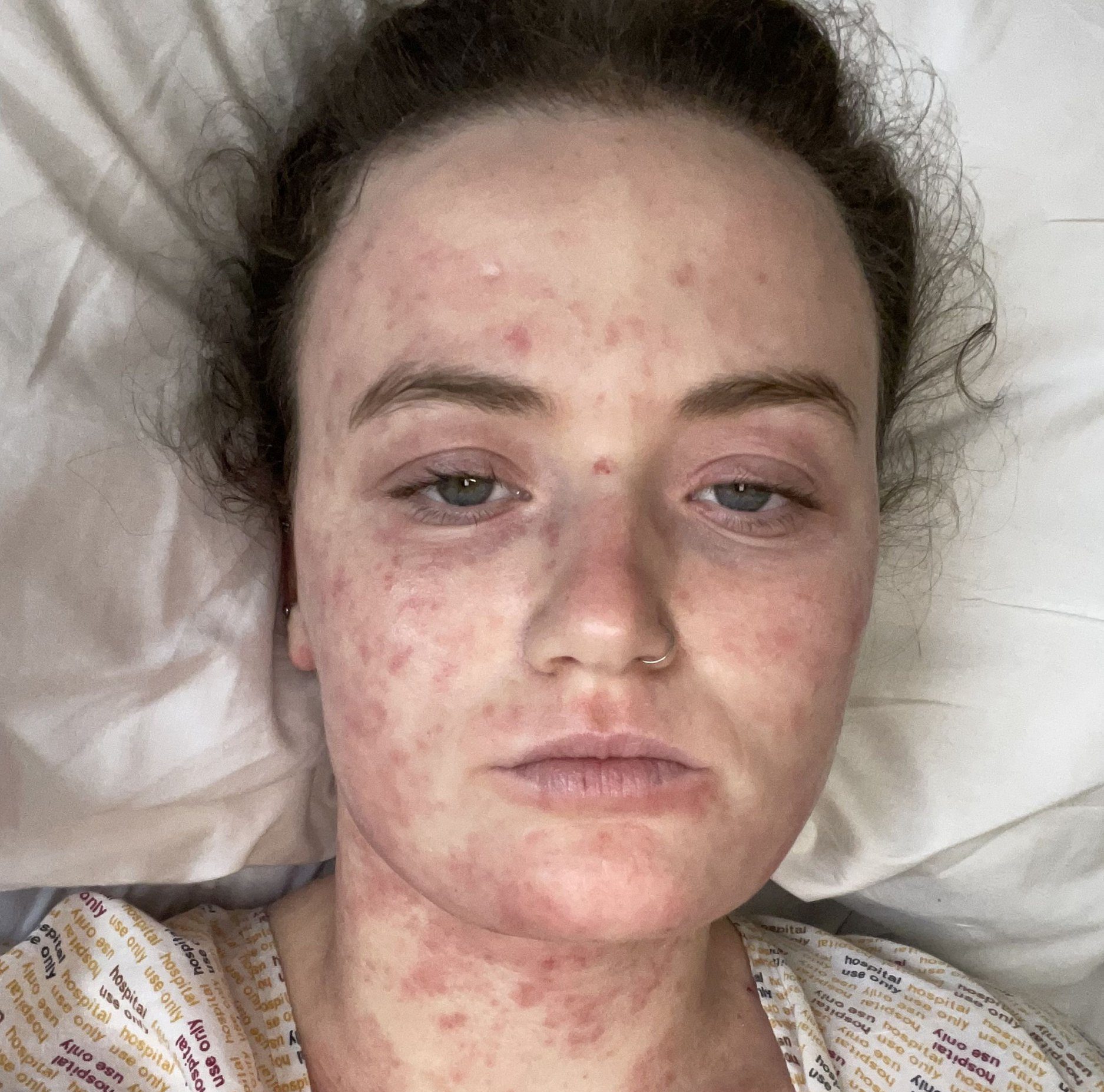 ‘I was diagnosed with deadly sepsis after experiencing a lesser-known