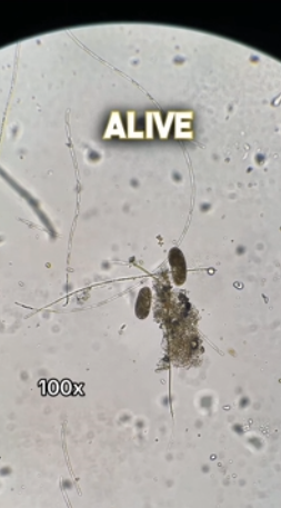 Bleach vs Microbes – Shocking Reactions Under the Microscope