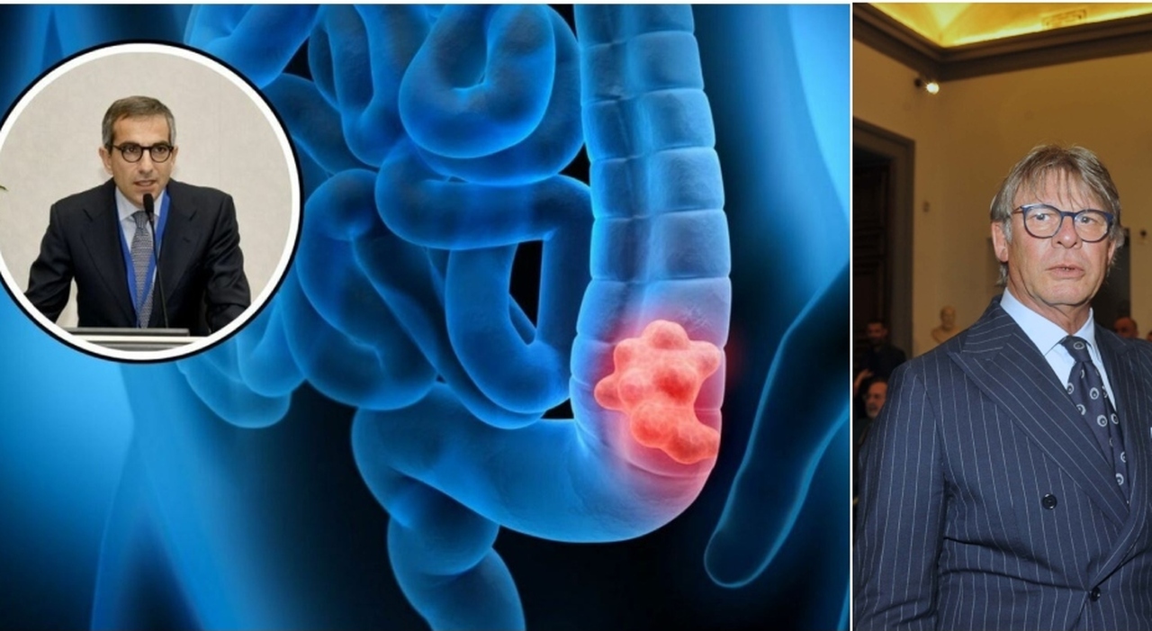 Sebino Nela e il tumore al colon. L'oncologo: «Ecco i 5 sintomi da non ...