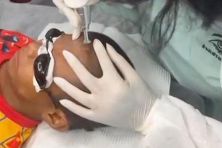 10YearOld Boy Undergoes Laser Tattoo Removal After Bullies Ink