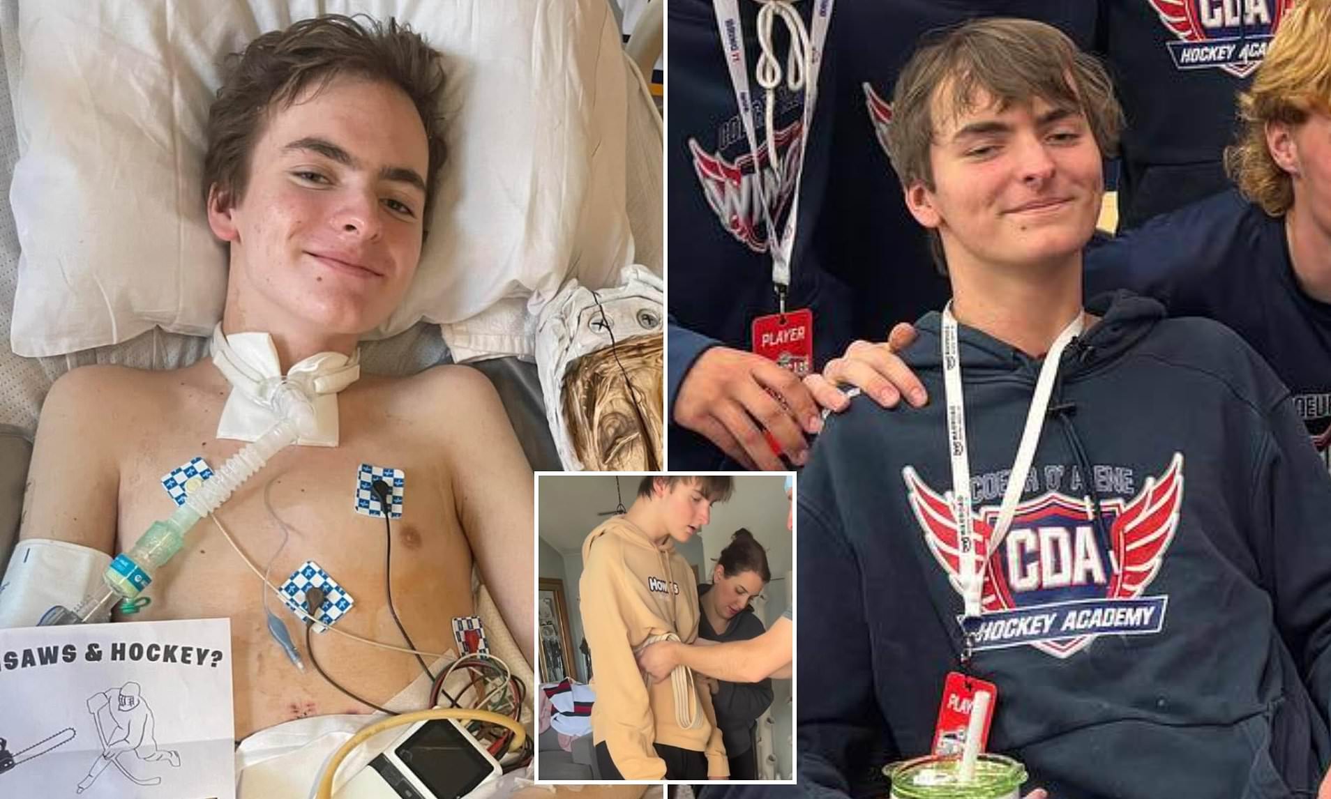 Recovery of boy, 18, who suffered the same kind of injury that ...