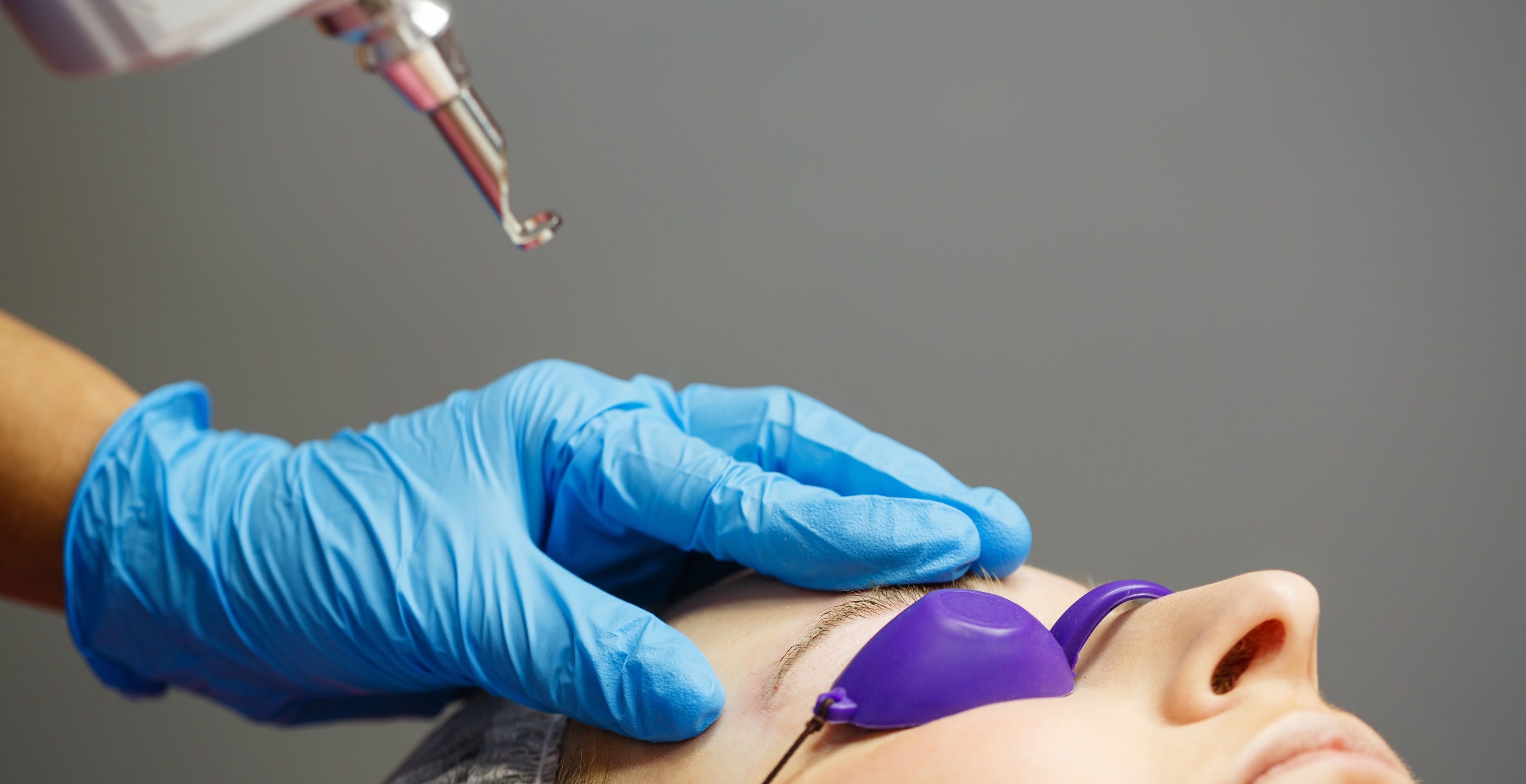 10YearOld Boy Receives Laser Tattoo Removal After Bullies Ink Bad