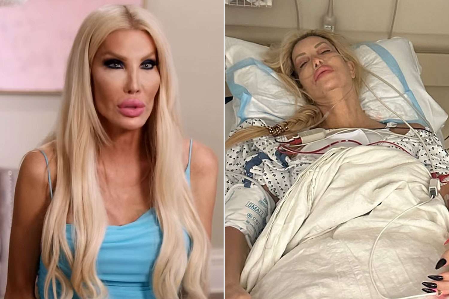 nikki exotika before and after plastic surgery Image 8