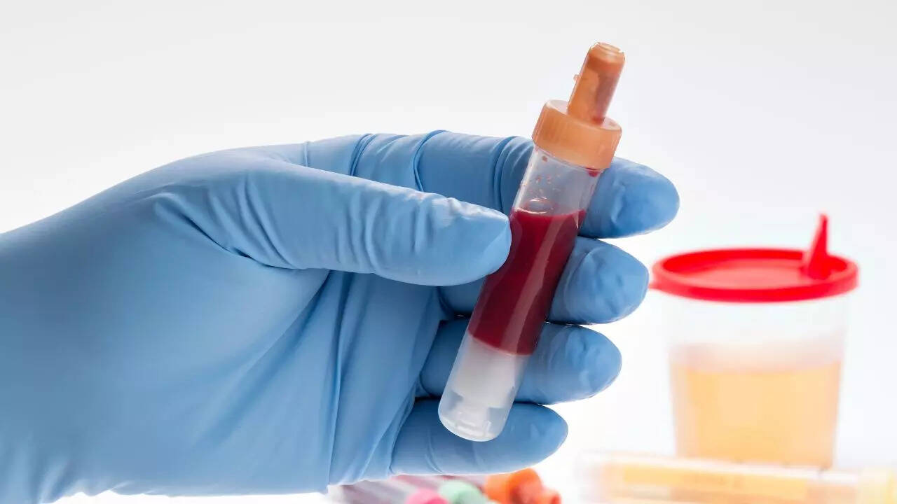 Is blood in urine a sign of kidney cancer? Know the causes, signs, and ...