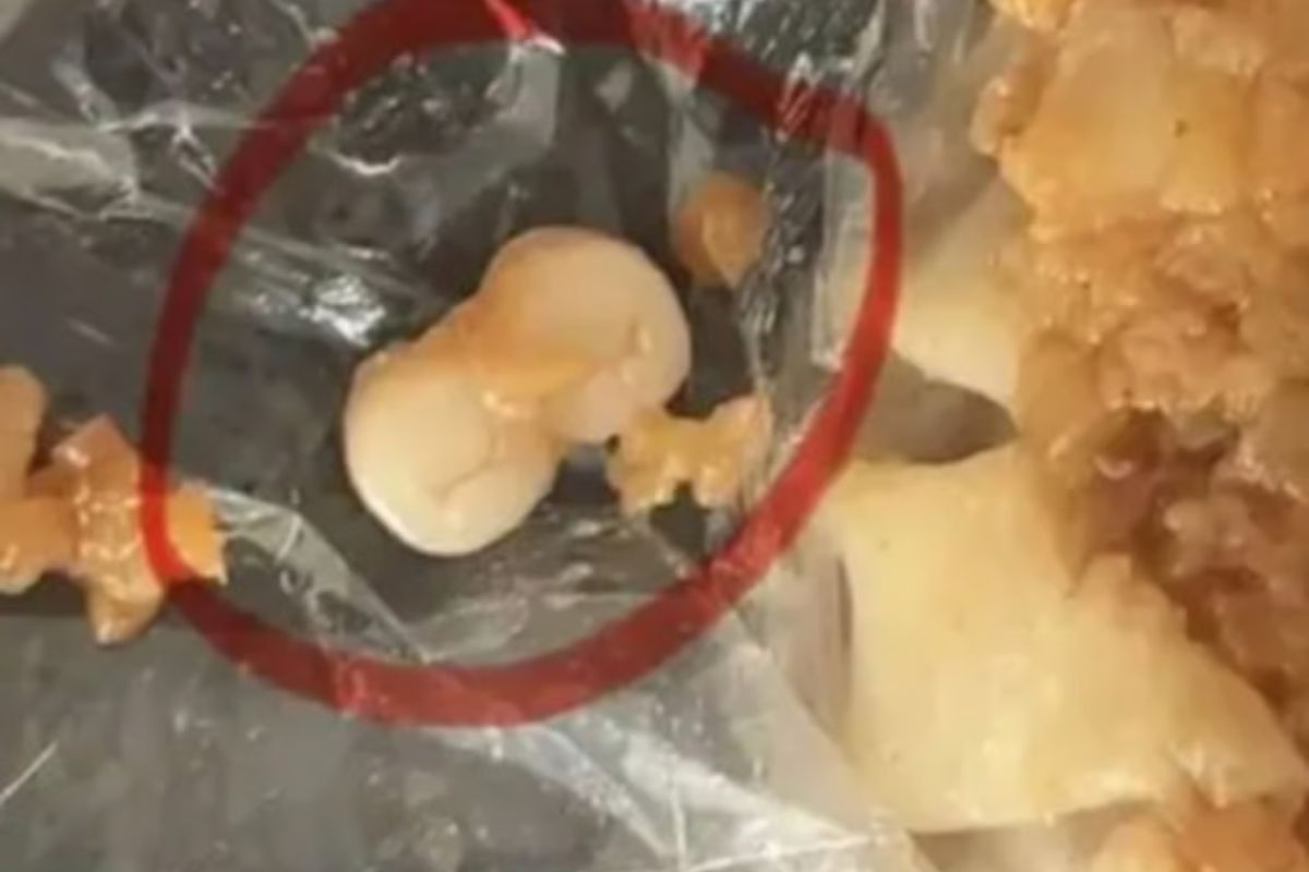 Mual! Pembeli Temukan Gigi Manusia di Sosis dan Dimsum, Otoritas Tiongkok Tangani Langsung