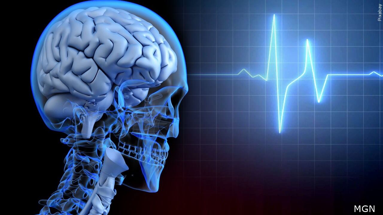 Kim Kardashian’s brain aneurysm highlights silent health threat