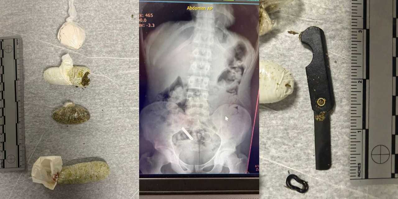 Albany Jail Inmate Caught With Razor, Drugs Hidden Inside