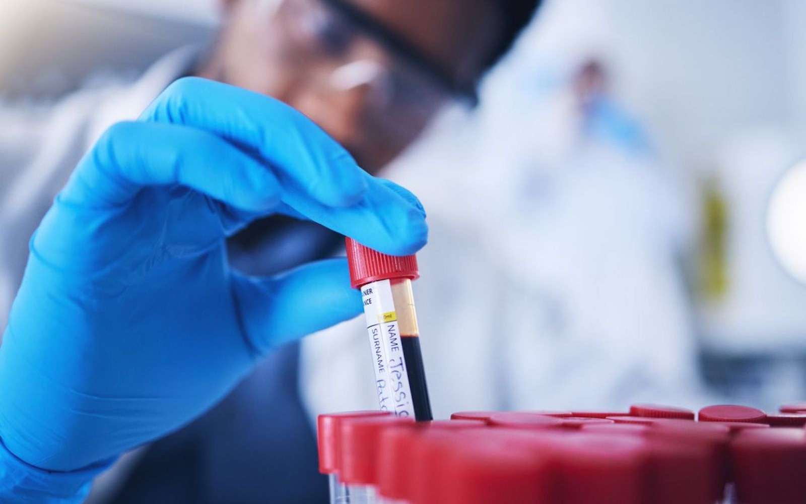 Ce simple test sanguin pourrait bientôt révolutionner le diagnostic d ...