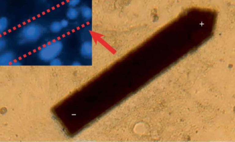 This Implant Smaller Than a Grain of Salt Can Track Brain Activity for ...