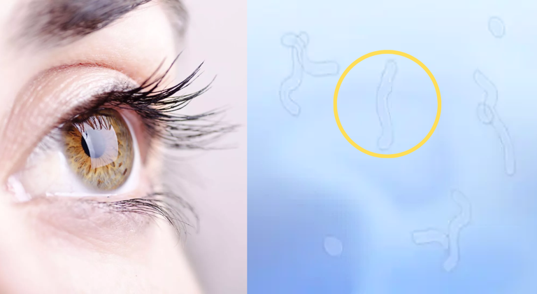 Seeing spots in your vision? Doctors reveal what’s happening inside ...