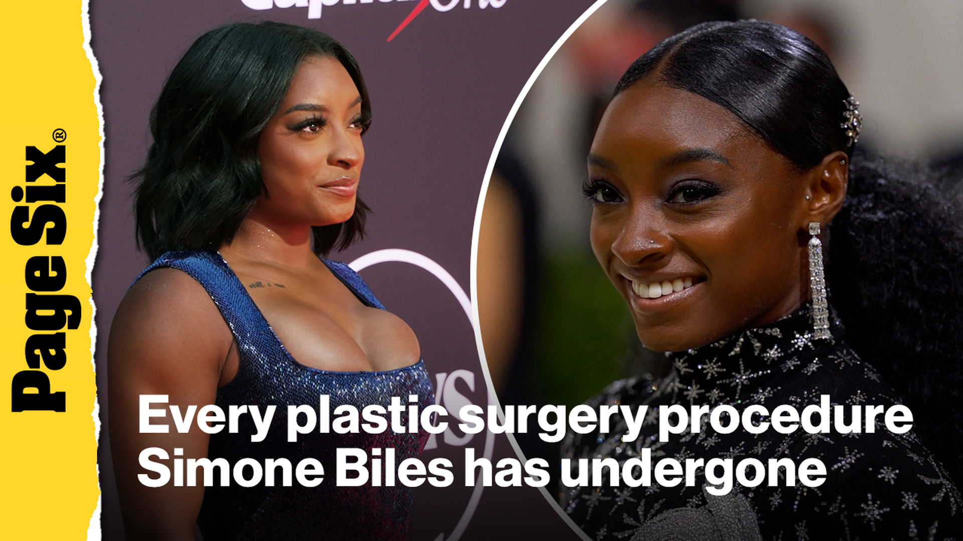 simone biles plastic surgery before and after Image 6