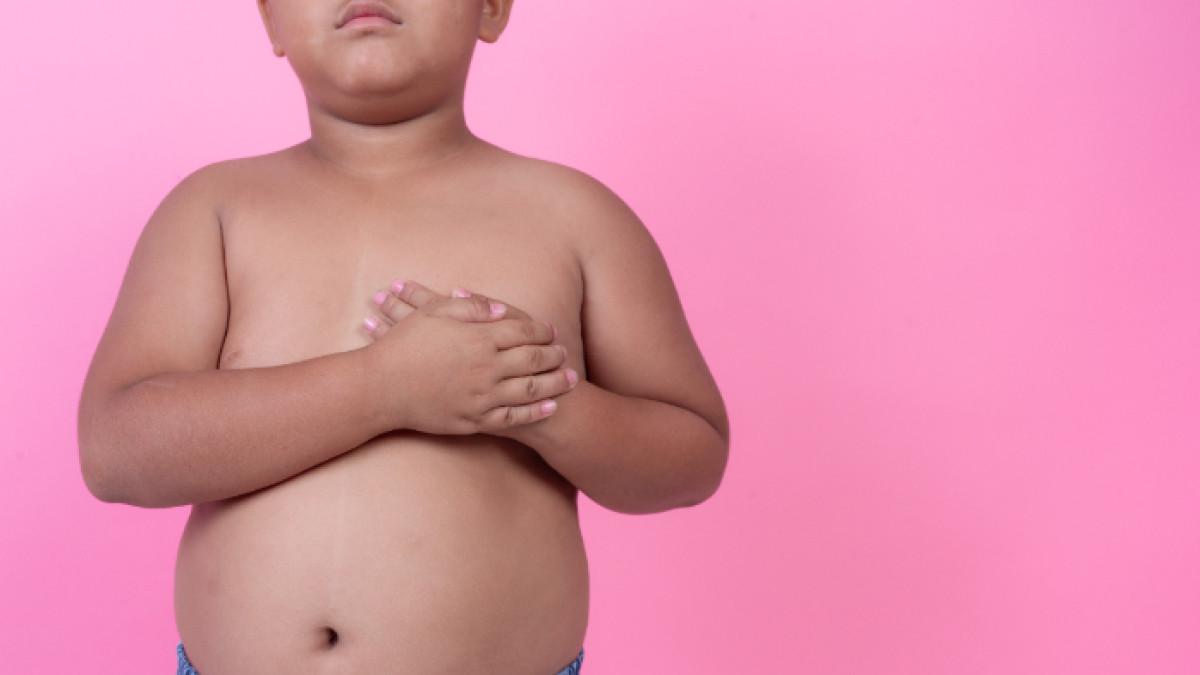 Cara Mengetahui Anak Obesitas atau Tidak