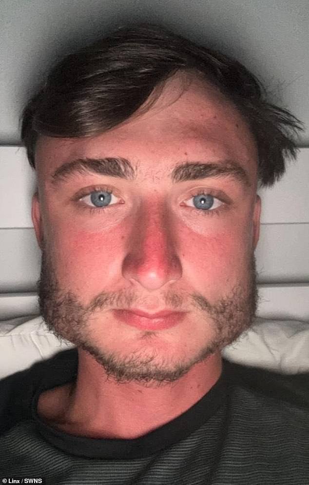 Boxer who has spent years bare-knuckle fighting has developed a square ...