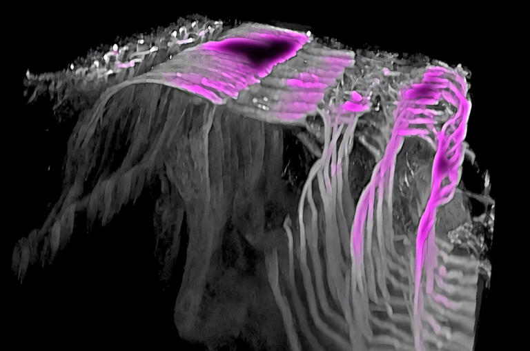 Genetically altered hair cells show how inner ear structures are organized
