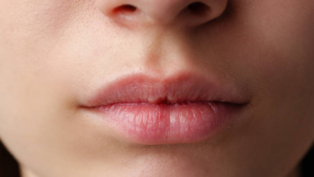 Say goodbye to dry and dull lips in winters with these expert tips