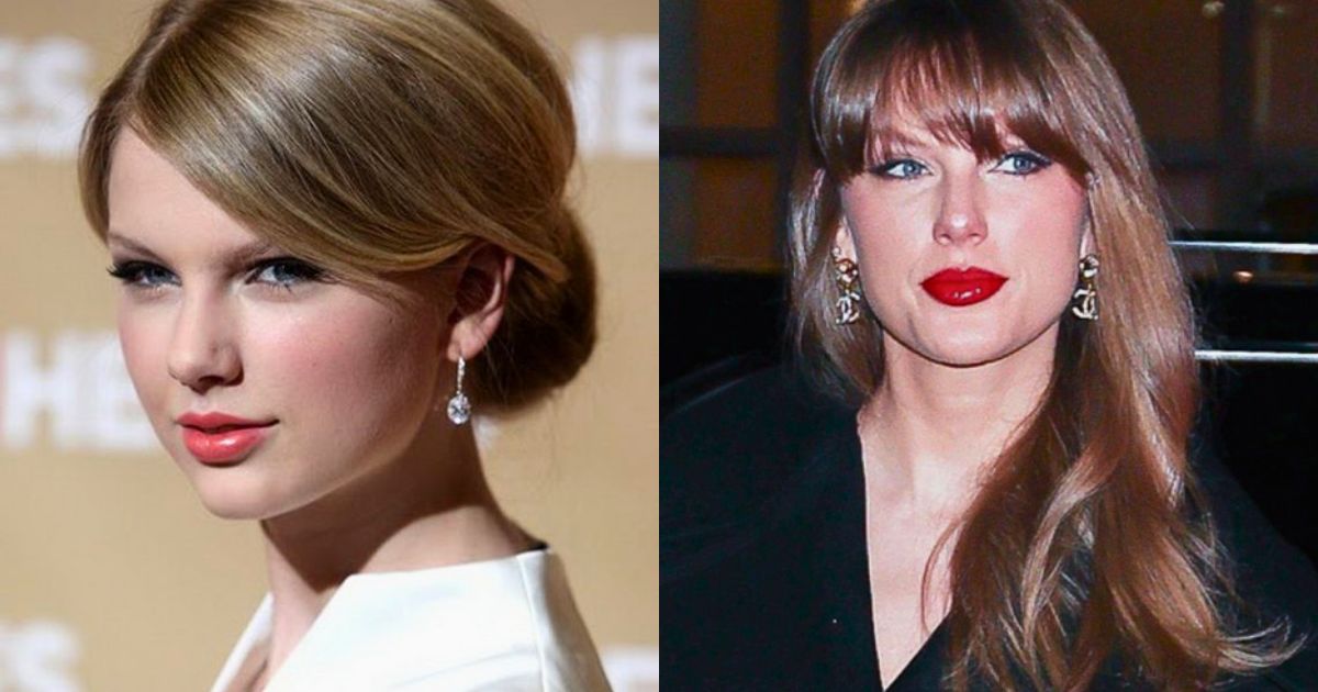 What’s Really Changed About Taylor Swift’s Face? Experts Weigh In