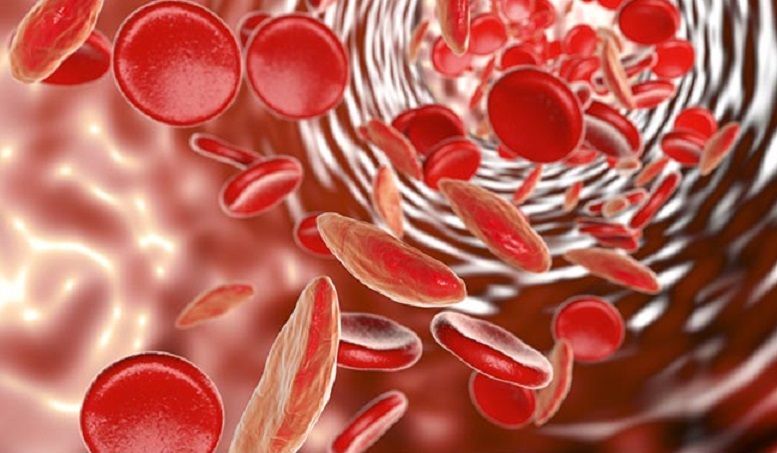 Mengapa Hemoglobin Menurun? Ini Penyebab dan Solusinya