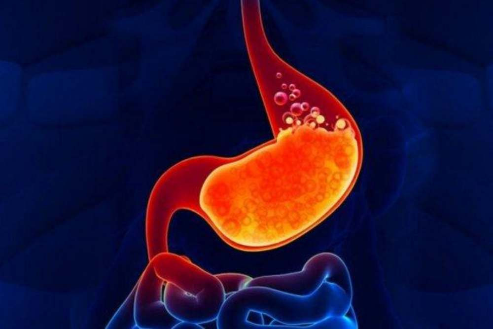 Waspada! Dampak Negatif Baju Ketat pada Tubuh Anda