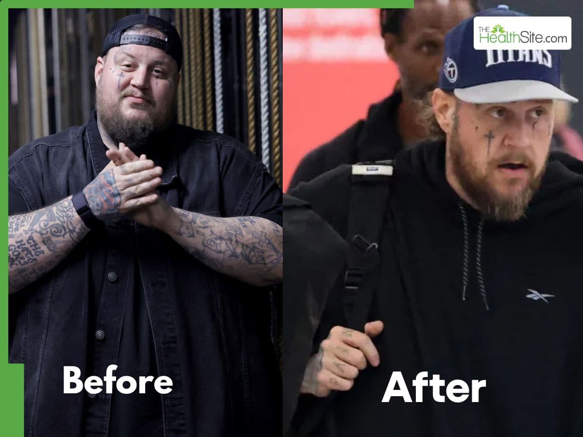 Jelly Roll Shocking Weight Loss: American Rapper Looks Unrecognizable ...