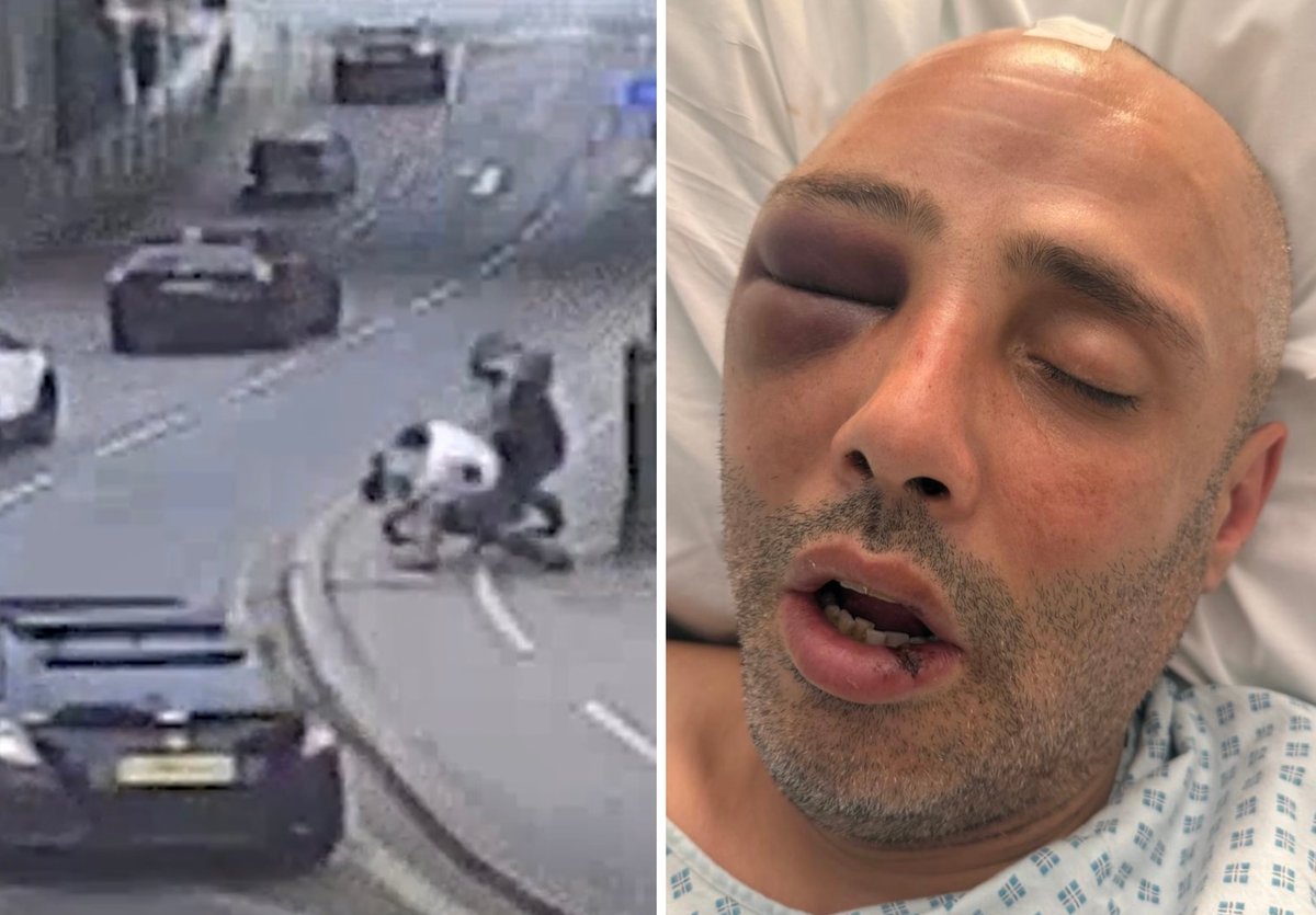 Cyclist nearly died after being hit by uninsured e-bike rider