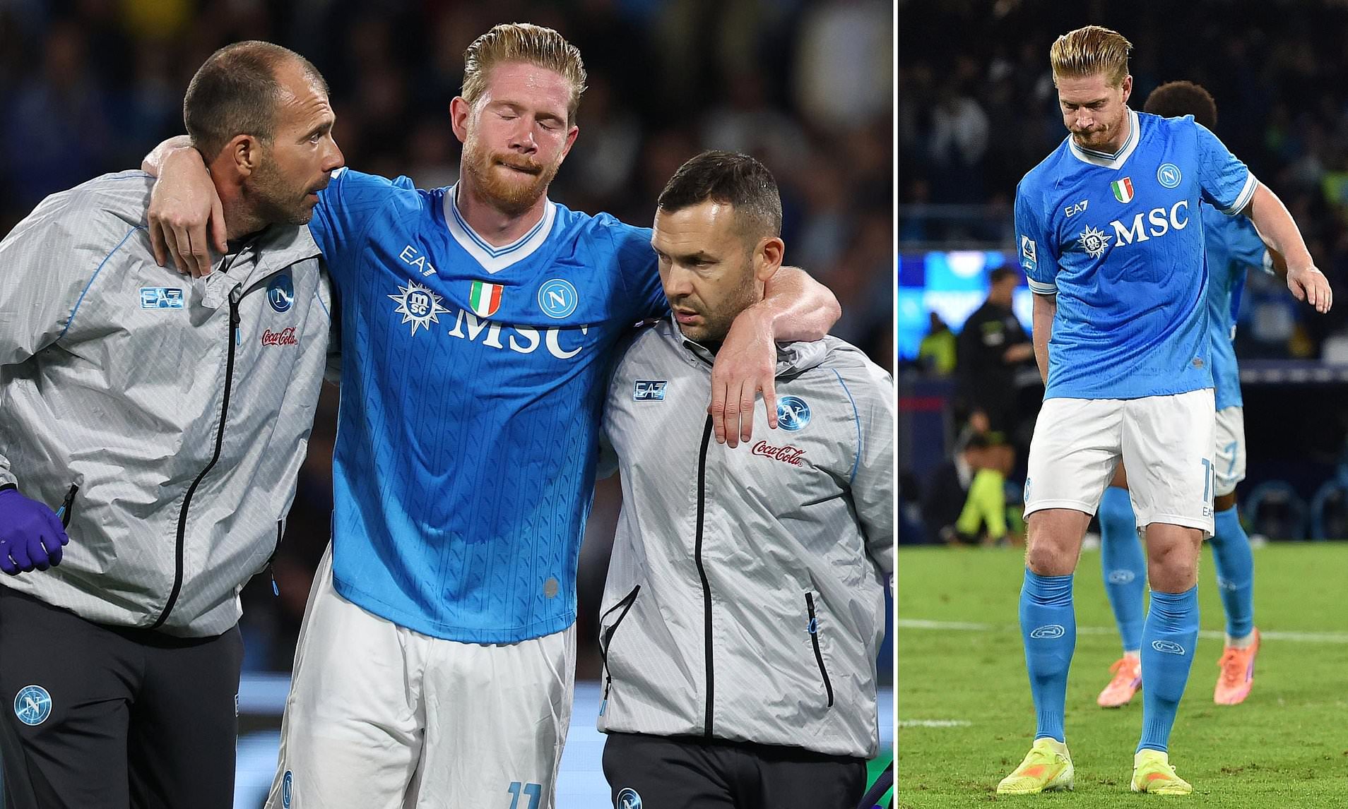 Kevin De Bruyne is facing MONTHS out with a bizarre injury he suffered ...