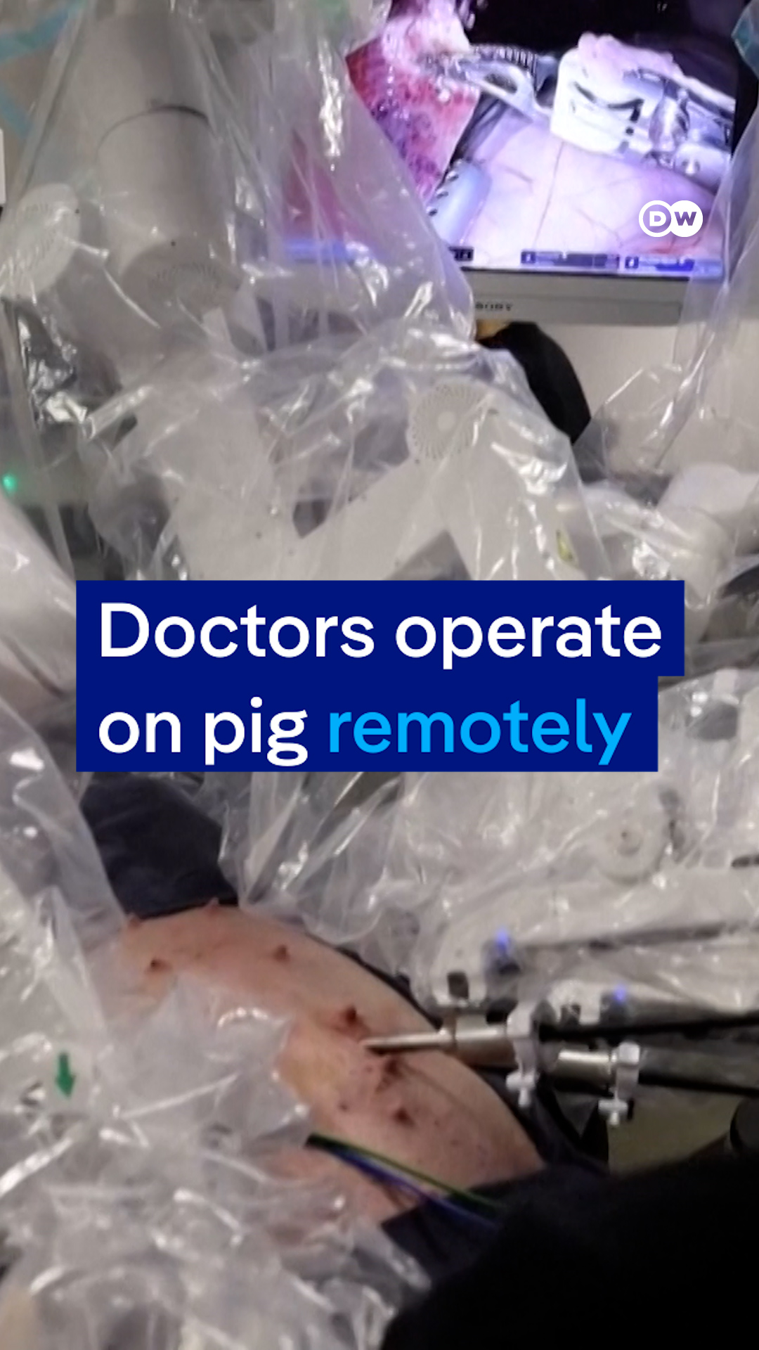 Doctors operate on pig remotely