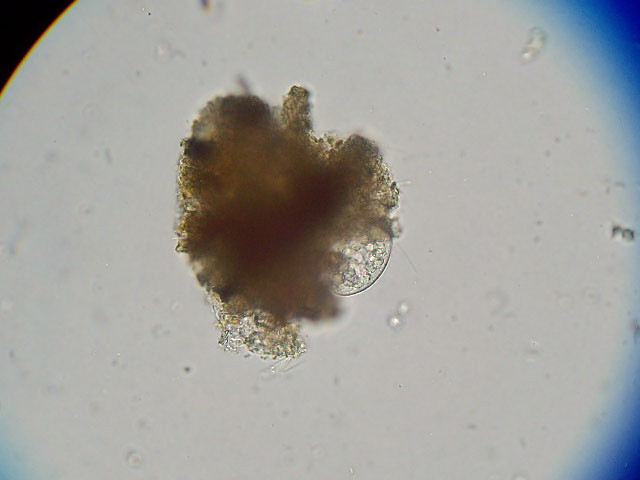 Complex Ecosystem of a Single Drop of Water