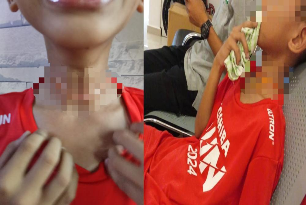Boy suffers neck injury after cycling into rope tied across field