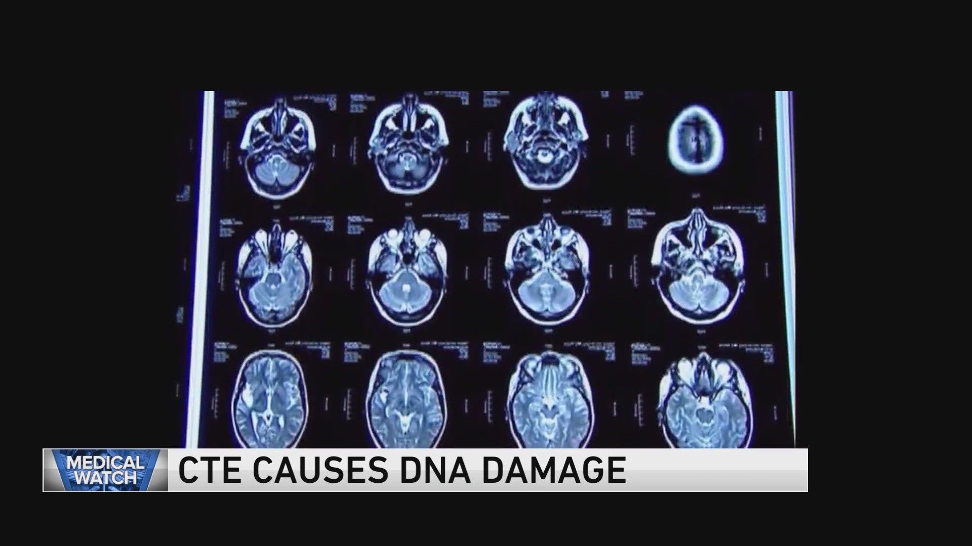 CTE causes DNA damage - plus more health headlines