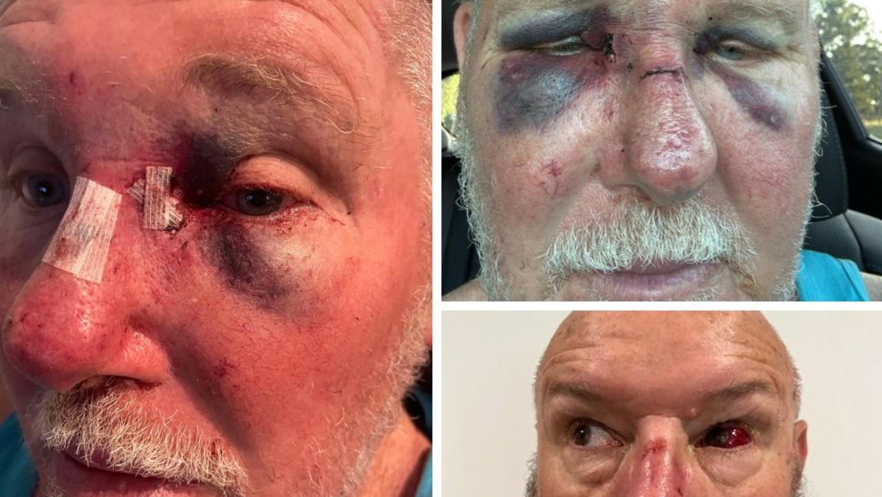 Judge fires up after sentence sparks strike