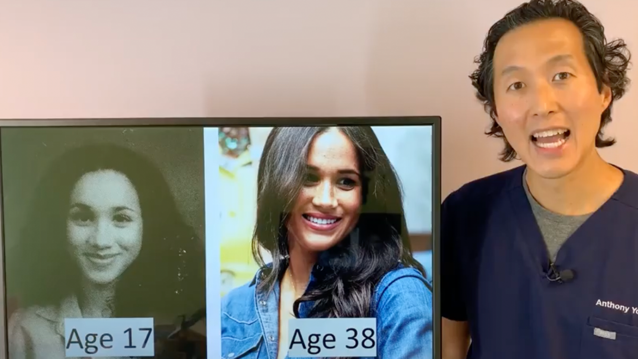 Uncovering The Truth: Did Sharon On Young And Restless Undergo Cosmetic Enhancements?