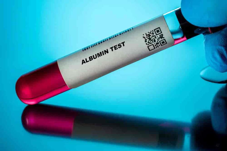 Albumin Blood Test Explained: What Your Results Really Say About Your ...