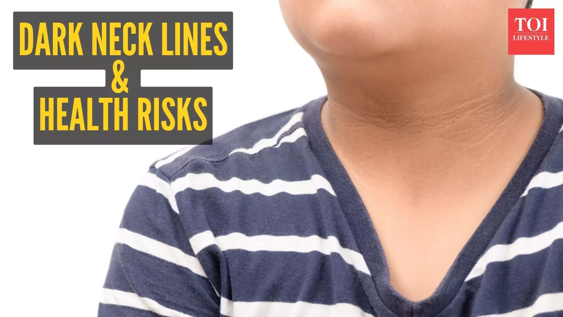 How dark neck can be linked to heart health, diabetes or fatty liver