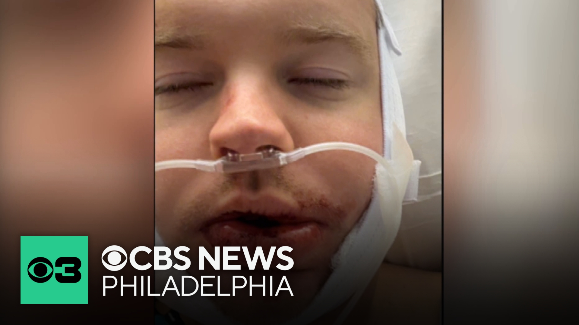 Suspect wanted after random attack leaves victim badly injured: 