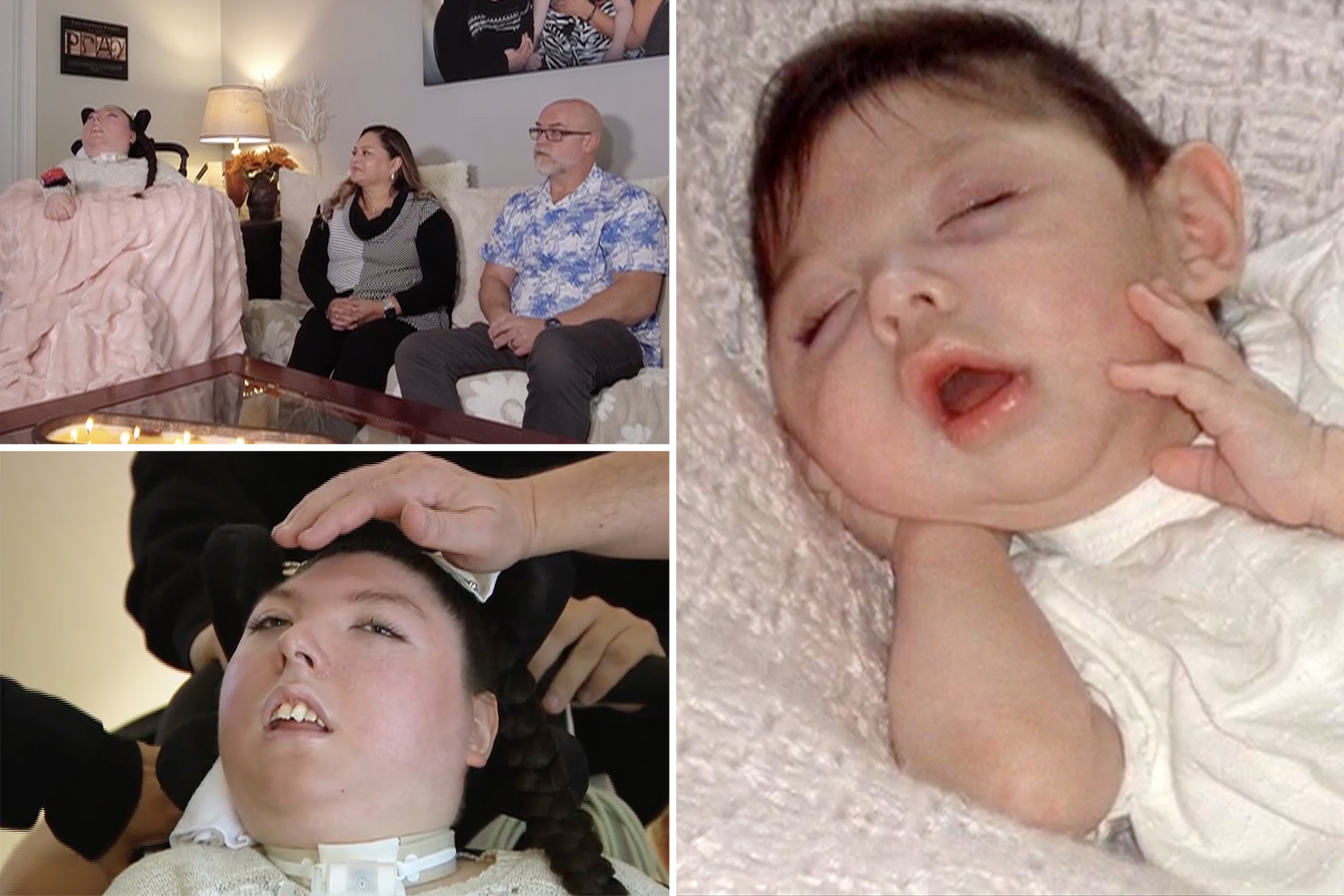 Woman born with no brain turns 20 in medical ‘miracle’