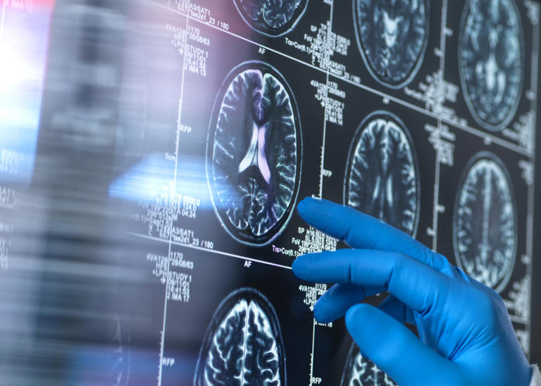 Adding creative activities to your routine could help you reverse brain ...