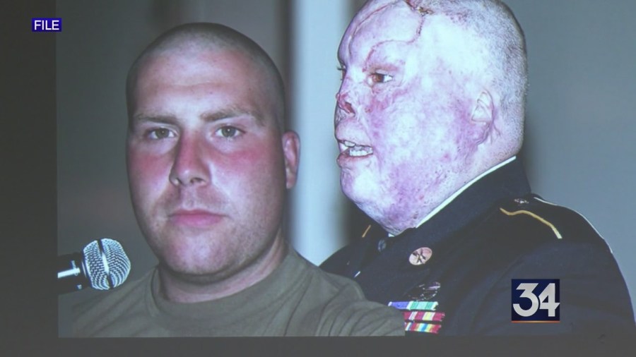 Veteran won’t let IED injuries define his life, future
