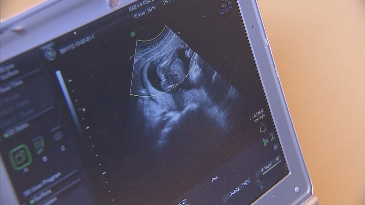 ‘A very difficult position’: South Carolina abortion bill could ...
