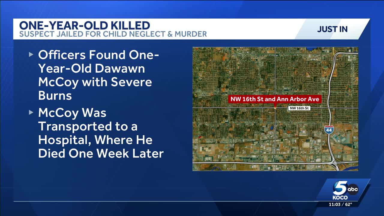 Man faces murder charge after 1-year-old boy who suffered severe burns ...