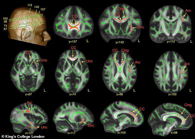 Is your dog autistic? Scientist claims pooches can be neurodivergent ...