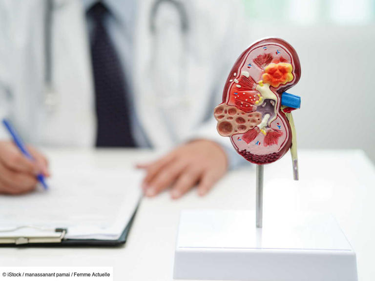 Une vague de maladies rénales silencieuses : près de 800 millions de ...