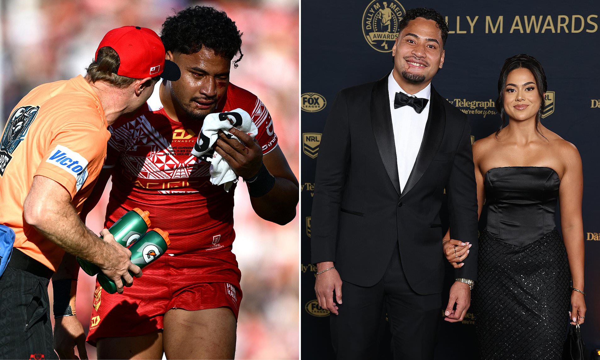 Storm's Katoa 'struggling to process' brain injury