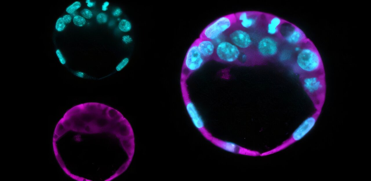 New roles found for STIP1 and Maspin proteins in cell renewal and structure