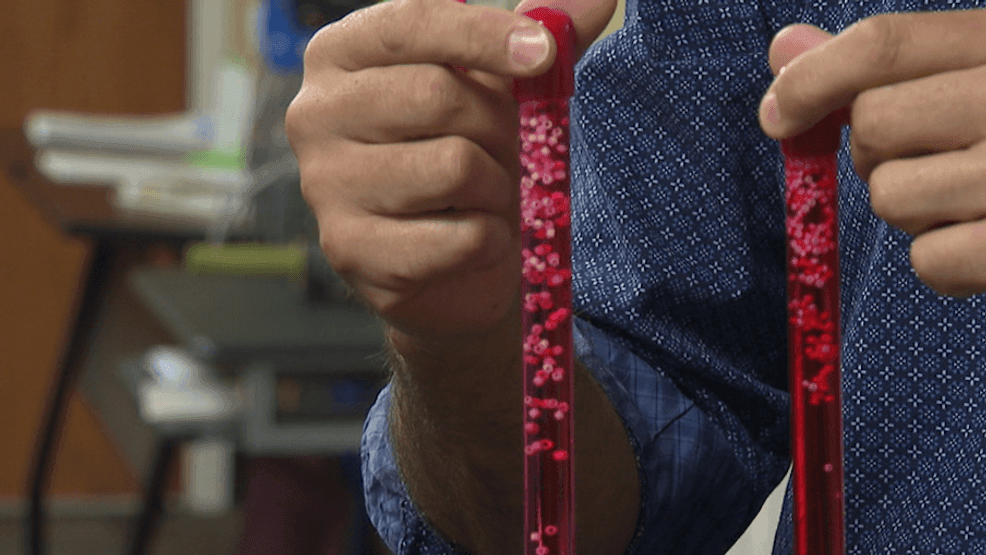 Nearly half of the U S population now has prediabetes according to