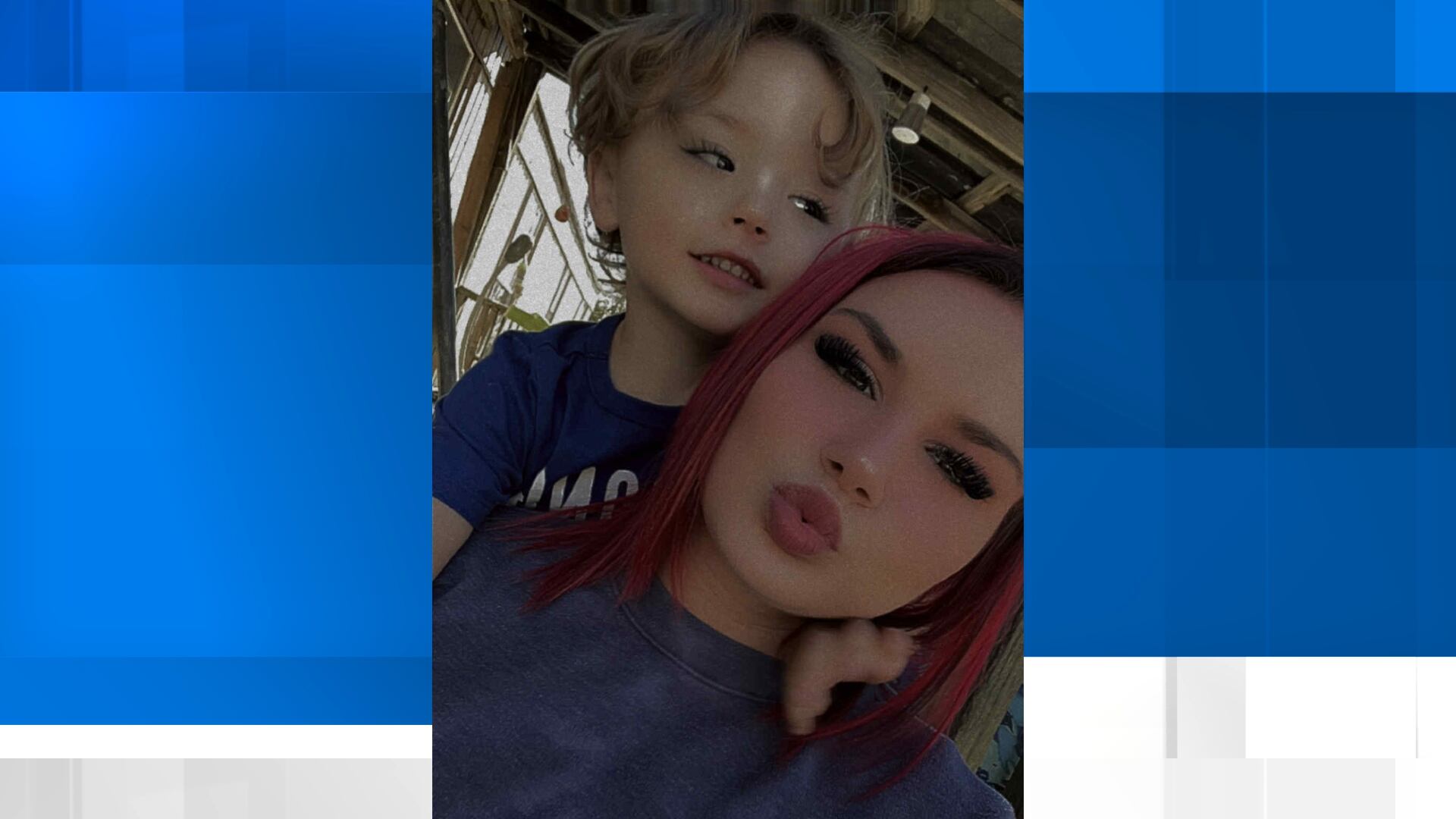 Three-year-old recovering after being attacked by dog in Lauderdale Co.