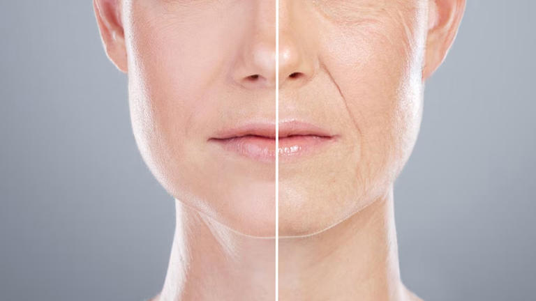 Can Drinking Collagen Water Really Improve Your Skin? Expert Shares